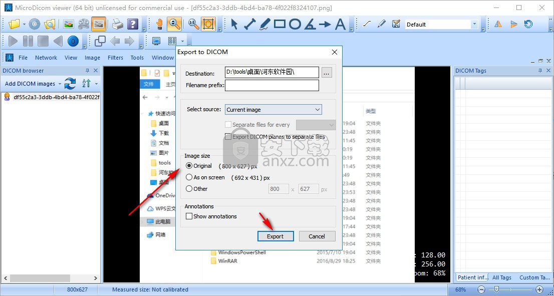 MicroDicom viewer(Dicom格式看图软件)