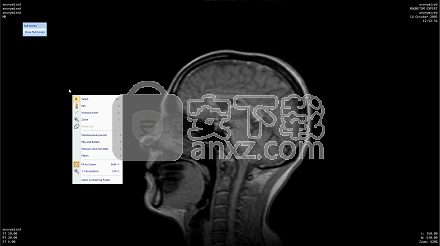 MicroDicom(医学看图软件)
