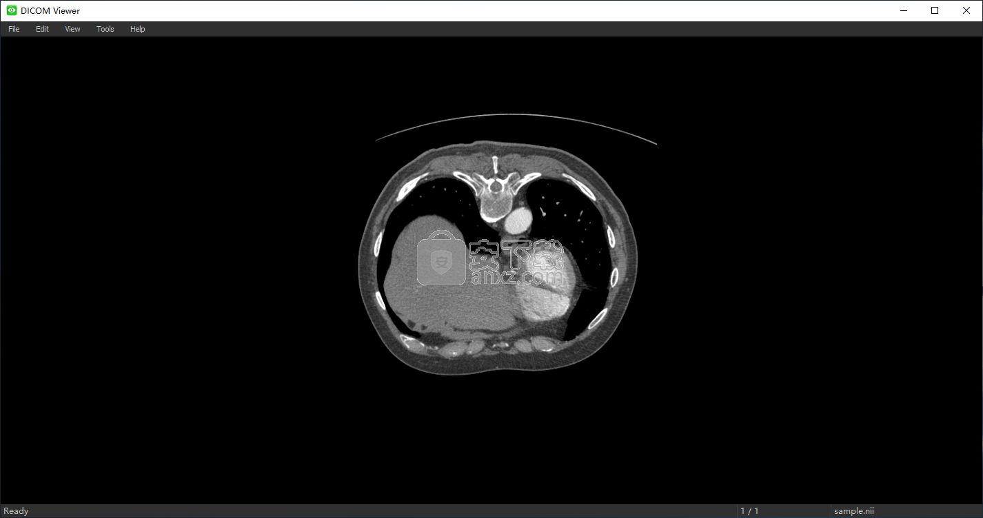 NIfTI to DICOM(NIfTI转DICOM工具)