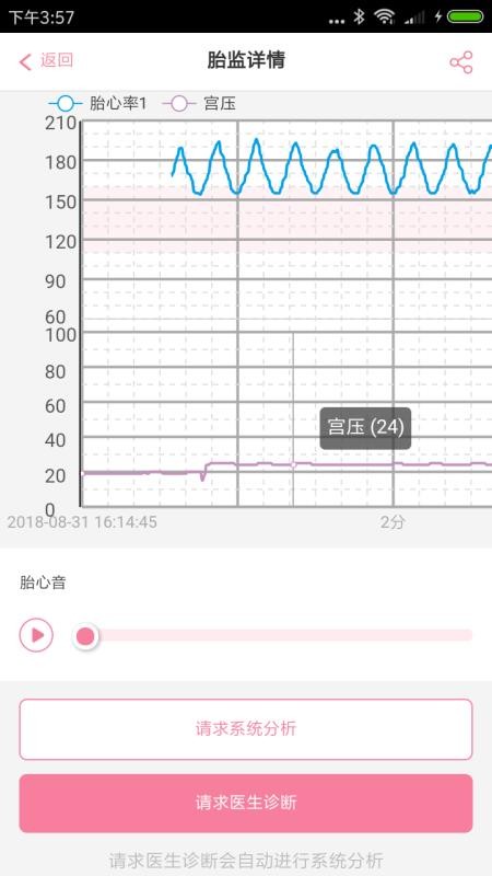 韵宝宝孕妇端