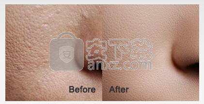 SkinFiner(磨皮美白工具)