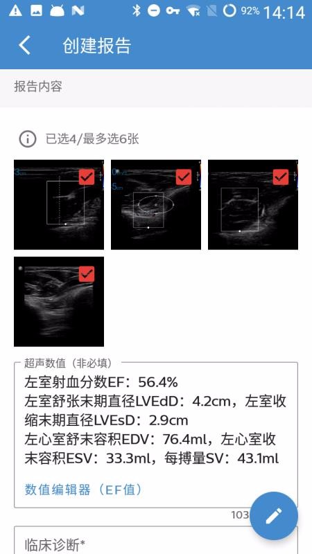 飞利浦超声报告(3)