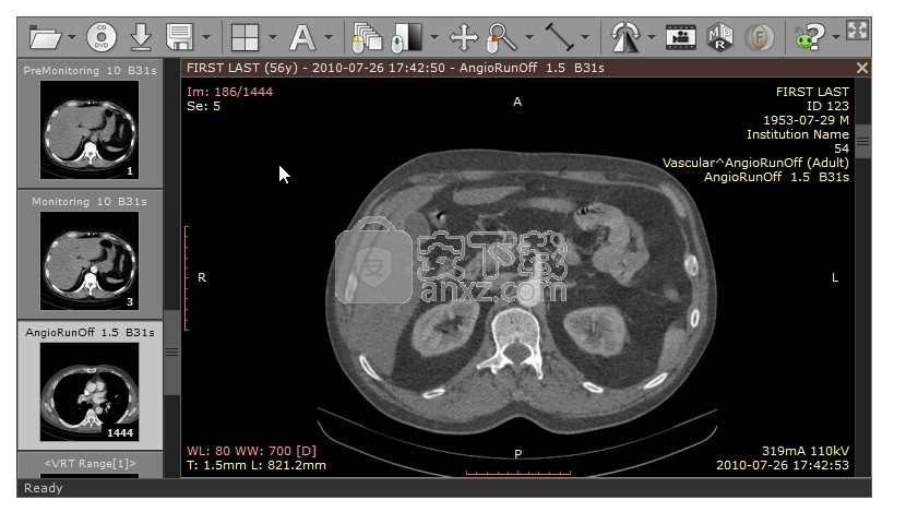 RadiAnt DICOM Viewer(dicom格式看图软件)